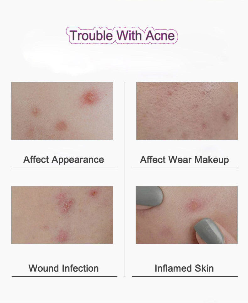 Docare Acne Treatment Patch